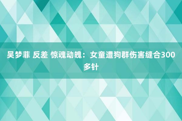 吴梦菲 反差 惊魂动魄：女童遭狗群伤害缝合300多针